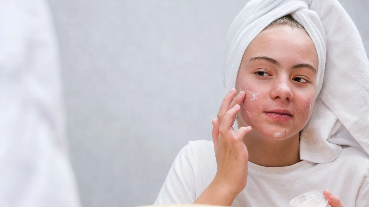 The Role of Sunscreen in Protecting Against Hyperpigmentation